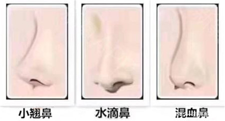 小翘鼻,水滴鼻,混血鼻,鼻部整形选择哪一款比较好?