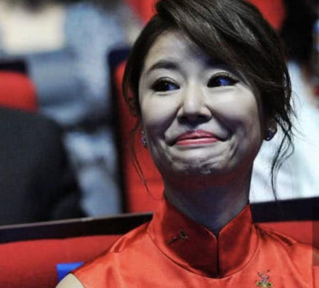 霍建华夫人林心如,如今的脸到底经历了什么?(图2) 霍建华夫人林心如,如今的脸到底经历了什么?(图2)