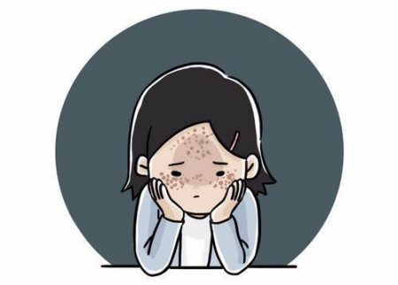 燃爆了（面部长斑什么原因）脸为什会长斑，面部长斑的原因和应对措施你了解多少？，